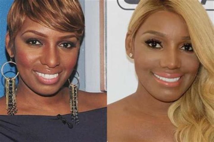 NeNe Leakes’ Fans Are Debating The RHOA Star’s Nose Following Her Latest Posts