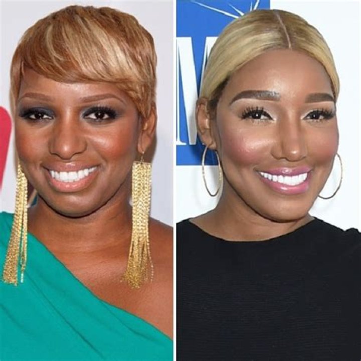 NeNe Leakes Poses Happily With Gregg Leakes After They Both Apologized For Hurting One Another